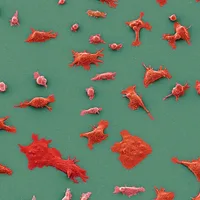 STAT+: Practice-changing results reported for Revolution Medicines pancreatic cancer drug
